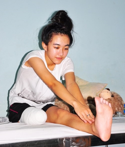Cô bé bị cưa chân do sự tắc trách của các bác sĩ tỉnh Đắk Lắk. (Ảnh: Internet)