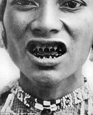 Phụ nữ dân tộc Bagobo mài răng nhọn