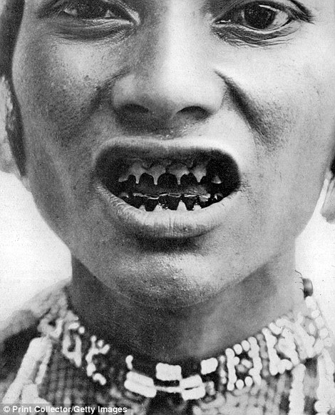 Ảnh chụp một người phụ nữ dân tộc Bagobo ở Mindanao, Philippines đã mài nhọn răng của mình vào năm 1910.