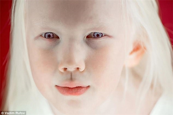 Nàng Bạch Tuyết 8 tuổi đẹp nhất xứ Siberia nhờ căn bệnh bạch tạng