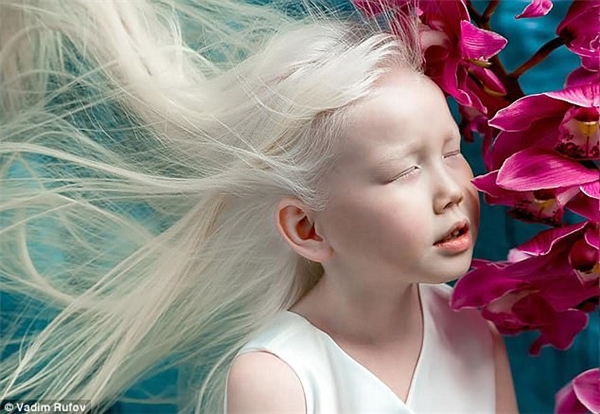 Nàng Bạch Tuyết 8 tuổi đẹp nhất xứ Siberia nhờ căn bệnh bạch tạng