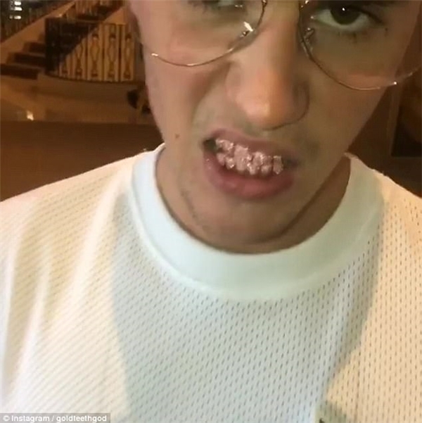 Justin Bieber chi hơn 341 triệu tậu răng giả bằng đá quý hồng lấp lánh