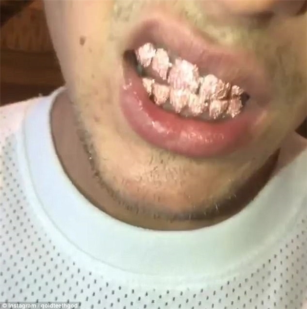 Sau siêu xe, biệt thự, Justin tiếp tục chơi trội với răng giả bằng đá quý.
