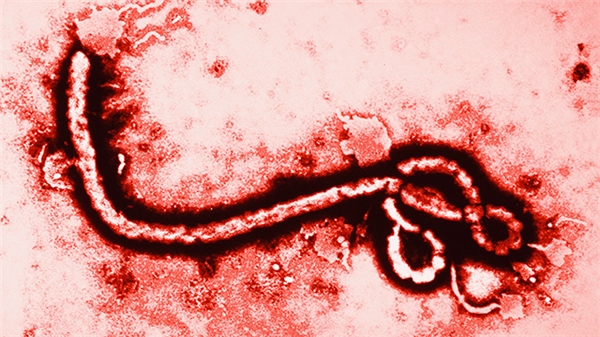 Hình ảnh virus Ebola được phóng đại gấp 108.000 lần
