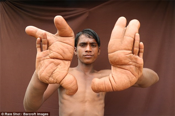 Các ngón tay cậu dài gần 12 inch (xấp xỉ 30cm)