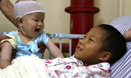 Cậu bé tươi cười cùng em trai - người cũng bị mắc căn bệnh tương tự nhưng nhẹ hơn