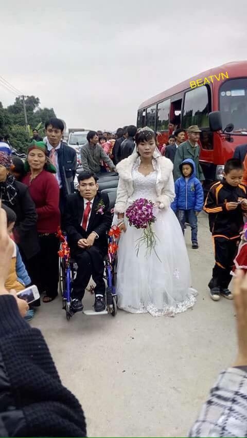 
Đám cưới của cặp đôi đũa lệch- chàng hoàng tử khuyết tật bên cạnh công chúa xinh đẹp