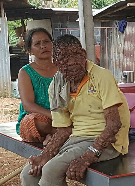 
Người đàn ông bị gán biệt danh "người đàn ông trồng nho" tại Thái Lan (Ảnh: Exclusive Media)