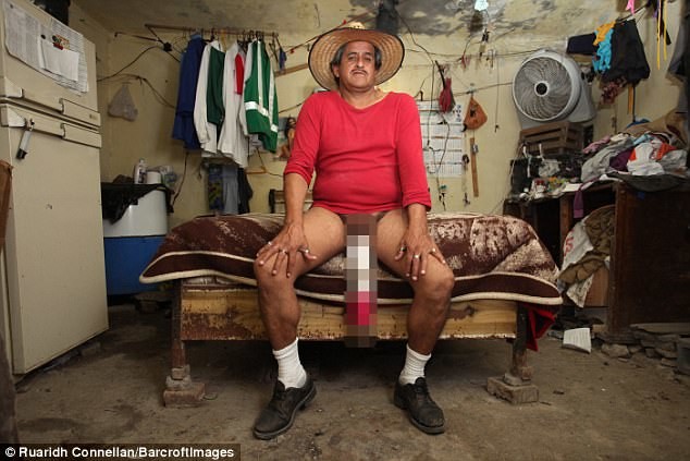 
Roberto Esquivel Cabrera, 54 tuổi đến từ một thị trấn phía Bắc của Saltillo có "của quý" dài tới gần 50cm