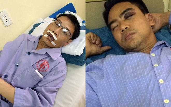 
Anh Quang (bên trái) và anh Điệp (phải) đang điều trị tại bệnh viện (Ảnh: Báo Quảng Ninh)