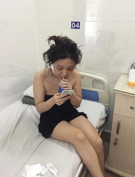 
Nhan sắc xuống cấp gây "sốc" của Kiều Anh Hera.