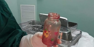 Sốc: Dùng bình sữa nhét vào hậu môn để... chữa thoái hóa cột sống Sốc: Dùng bình sữa nhét vào hậu môn để... chữa thoái hóa cột sống