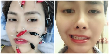 Cảnh báo: Nằm trong phòng điều hòa quá lạnh có thể khiến bạn bị méo miệng Cảnh báo: Nằm trong phòng điều hòa quá lạnh có thể khiến bạn bị méo miệng