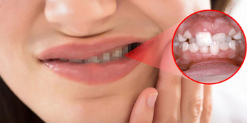 Nghiến răng khi ngủ: Đây là một loại bệnh để lại hậu quả khôn lường, đừng xem thường! Nghiến răng khi ngủ: Đây là một loại bệnh để lại hậu quả khôn lường, đừng xem thường!