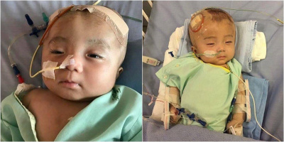 Em bé não úng thủy bị bỏ rơi trước cổng chùa: Sức khỏe nguy kịch