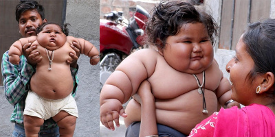 Choáng với bé gái nặng nhất thế giới: mới 8 tháng đã 17kg