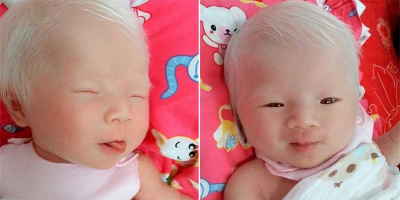 Bé gái hơn 10 ngày tuổi đầu tóc "bạc phơ" khiến dân mạng thích thú