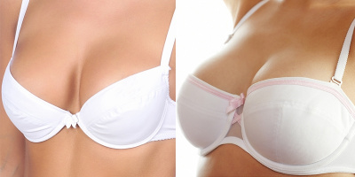 Tốt hay xấu những biện pháp nâng cấp vòng 1 được phái đẹp chuộng nhất?