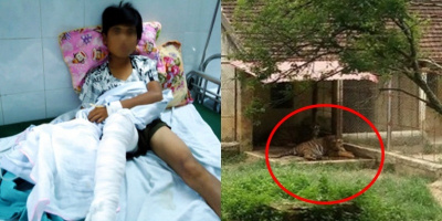 Cậu bé 13 tuổi ở Thanh Hóa bị thương nghiêm trọng do hổ vồ