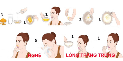 Tẩy ngay ria mép đáng ghét bằng những thứ cực kỳ dễ tìm thấy trong nhà bạn