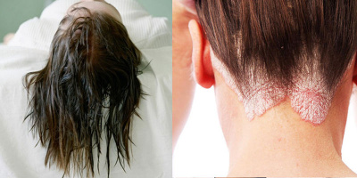 Không muốn sống chung với một đống vi khuẩn thì nhớ đừng để tóc còn ướt rồi đi ngủ nhé!