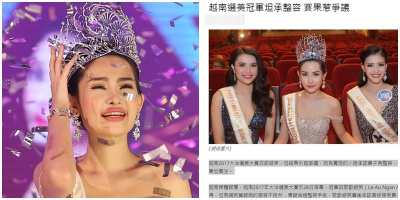 Báo Hoa ngữ đưa tin về tân Hoa hậu Đại Dương 2017 phẫu thuật thẩm mỹ