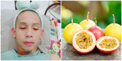 Mặt nạ chanh dây trong truyền thuyết của Hồng Duy Pinky hóa ra có thật và hiệu quả bất ngờ