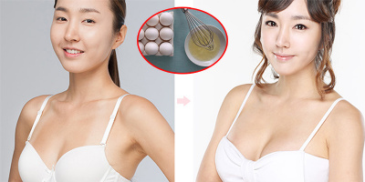 Các nhà khoa học Nhật Bản bật mí phương pháp nâng ngực hiệu quả bằng... lòng trắng trứng