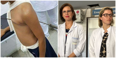 Em bé may mắn sống sót sau khi bị chiếc xiên nướng thịt xuyên qua tim