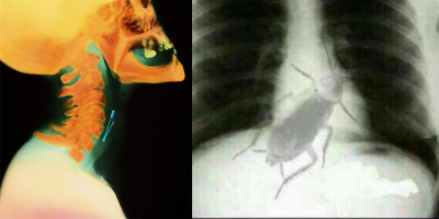 Xem ảnh chụp X-quang mà nhiều người ngỡ rằng đang được xem phim kinh dị