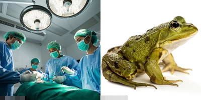 Tin bài thuốc cổ truyền ăn 3 con ếch sống, người phụ nữ vô tình "nuôi" sán dài gần 13cm trong cơ thể