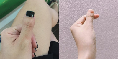 Dân mạng “phát sốt” với trào lưu khoe ảnh “ngón tay như ngón chân”