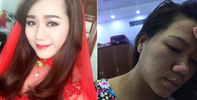 9x chấp nhận cơ thể "xuống cấp không phanh", da sạm đen, mụn chi chít chỉ để giữ thiên chức "làm mẹ"