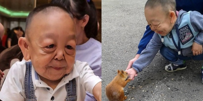Dân mạng hốt hoảng trước cậu bé 6 tuổi mang gương mặt nhăn nheo của ông lão 60 tuổi