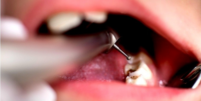 Mối liên kết mật thiết giữa răng miệng và các cơ quan nội tạng, chìa khóa giúp dự đoán sớm ung thư