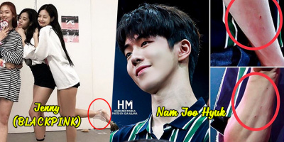 Những trường hợp thần tượng Hàn Quốc bị chính người hâm mộ của mình gây thương tích