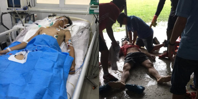 Đá banh dưới trời mưa, người đàn ông bị sét đánh nguy kịch