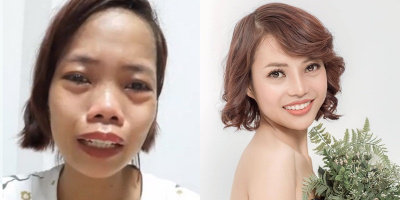 Mẹ đơn thân bị miệt thị "hóa" hotgirl sau phẫu thuật thẩm mỹ: "Từng trách mẹ sao đẻ con ra xấu thế"