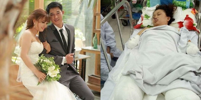 CĐM xót xa mẹ trẻ bị áp xê ngực sau sinh gây biến chứng phải cắt cụt tứ chi để giữ mạng sống