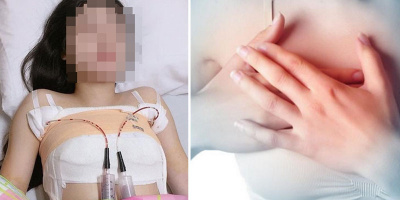 Góc Cảnh Giác: Người phụ nữ buộc phải cắt bỏ ngực trái vì phẫu thuật thẩm mỹ bị nhiễm trùng