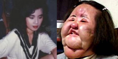 "Thảm họa thẩm mỹ" Han Mi Ok qua đời ở tuổi 57: Điên cuồng phẫu thuật, tự tiêm dầu ăn vào mặt