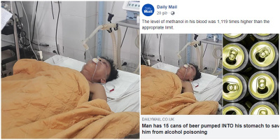 Báo chí quốc tế rầm rộ đưa tin người đàn ông Việt truyền 15 lon bia để giải độc rượu: "Thật khó tin"