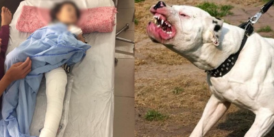 Chó pitbull giật xích, lao ra tấn công bé gái 2 tuổi, hàng xóm phải dùng xà beng đập chết