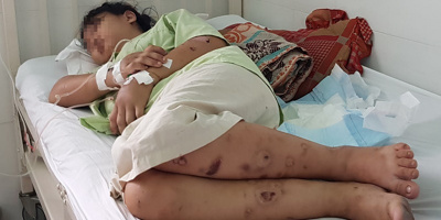 Thai phụ nhớ lại 20 ngày "địa ngục trần gian" bị nhốt, đánh đập: "Em van xin tha mạng không được"