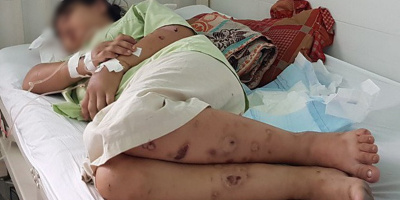 Thông tin mới nhất vụ cô gái trẻ bị giam giữ, đánh đập đến sinh non tại Sài Gòn