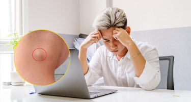 Đây chính là những dấu hiệu cảnh báo nguy cơ ung thư giai đoạn cuối
