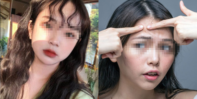 Nỗi khổ của con gái: Cứ đến ngày quan trọng là mụn thi nhau mọc