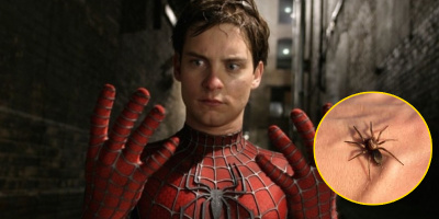 Với ước mơ trở thành Spiderman, 3 anh em nhập viện vì để nhện độc cắn