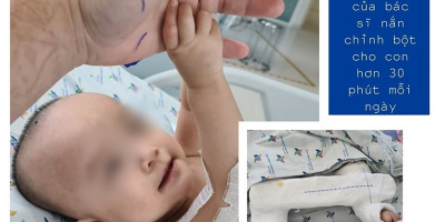 Trúc Nhi - Diệu Nhi sẽ tập đi trong 6 tuần tới sau khi cắt cây bột