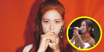 Jisoo (BLACKPINK) lộ hạch to ở cổ, fan lo bệnh cũ của idol tái phát